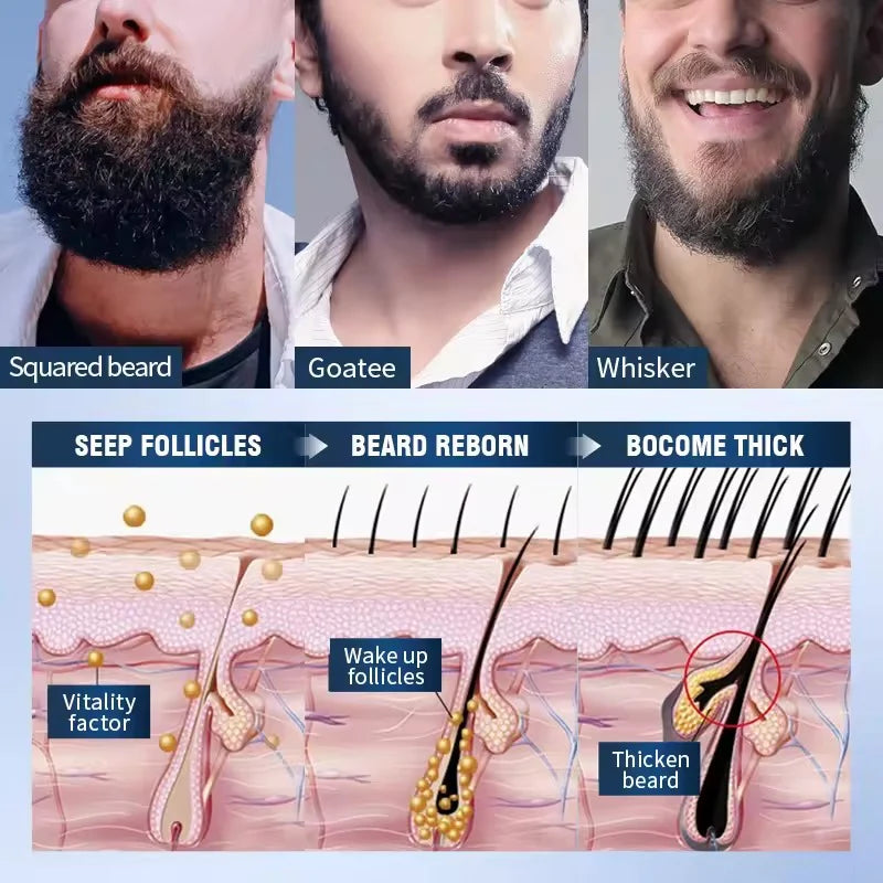 SADOER 5-Piece Thick Beard Nursing Kit